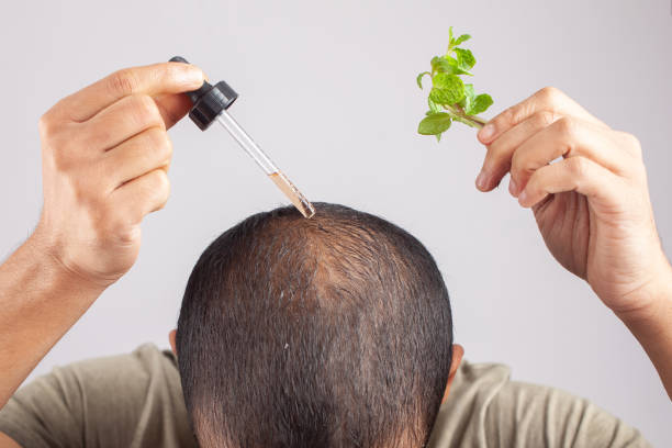 THRIVE HAIRE OIL- Huile de croissance cheveux- CG