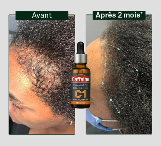 Huile anti-chute cheveux